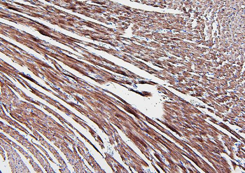 Aldolase/ALDOA Antibody