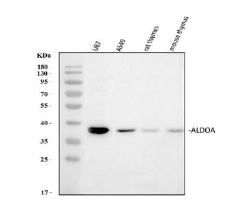 Aldolase/ALDOA Antibody