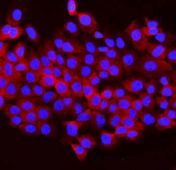 Aldolase/ALDOB Rabbit Polyclonal Antibody