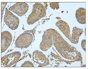 BubR1/BUB1B Antibody
