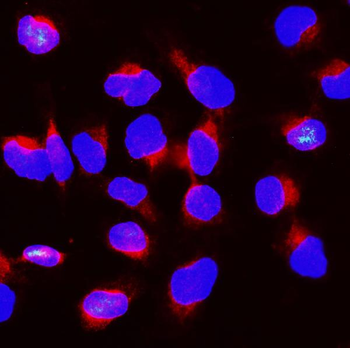 BubR1/BUB1B Antibody
