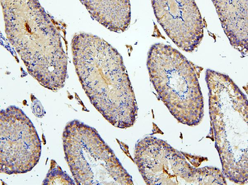 BubR1/BUB1B Antibody
