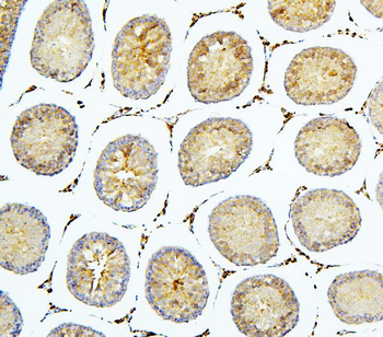 BubR1/BUB1B Antibody