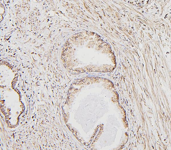 Calreticulin/CALR Antibody