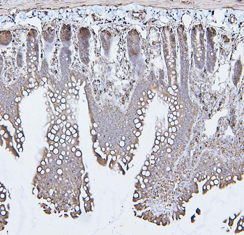 Calreticulin/CALR Antibody