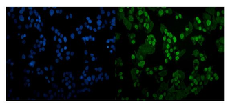 CEBP Alpha/CEBPA Rabbit Polyclonal Antibody