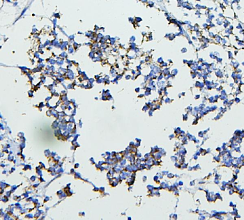 CETP Antibody