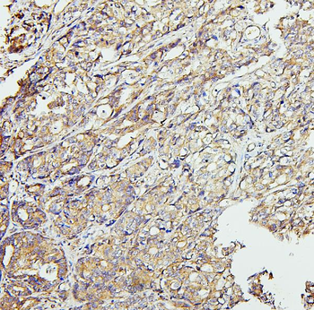 CETP Antibody