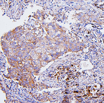 CETP Antibody