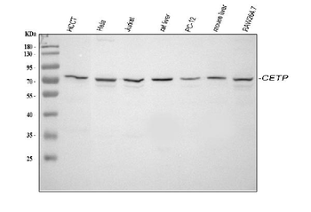 CETP Antibody