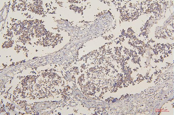 TORC1/CRTC1 Rabbit Polyclonal Antibody