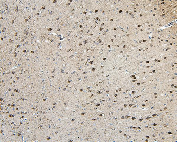 TORC1/CRTC1 Rabbit Polyclonal Antibody