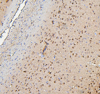 TORC1/CRTC1 Rabbit Polyclonal Antibody