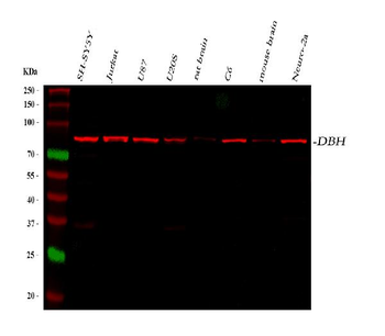 Dopamine beta Hydroxylase/DBH Rabbit Polyclonal Antibody