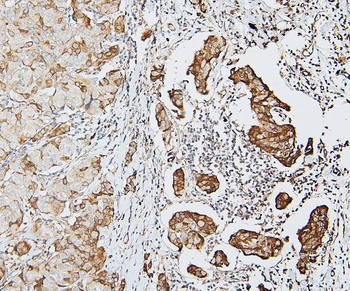 MCK10/NEP/DDR1 Antibody