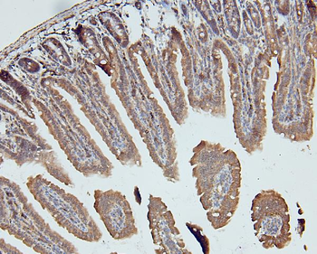 MCK10/NEP/DDR1 Antibody