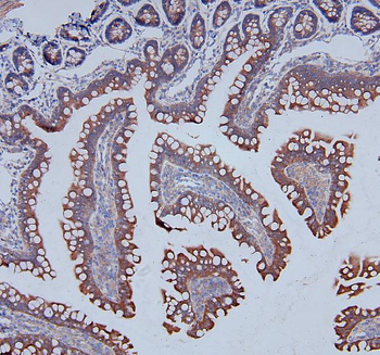 MCK10/NEP/DDR1 Antibody