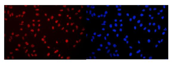DDX5 Antibody