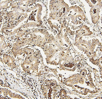 DDX5 Antibody