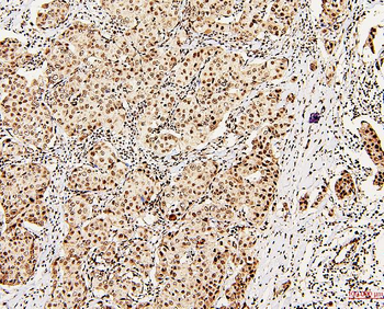 DDX5 Antibody