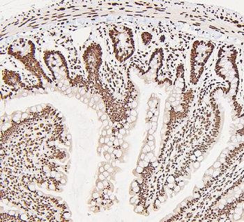 DDX5 Antibody