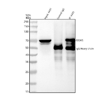 DDX5 Antibody
