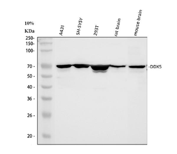 DDX5 Antibody