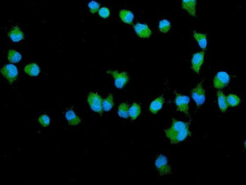 Filamin A/FLNA Antibody