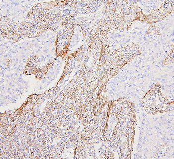 Filamin A/FLNA Antibody
