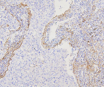 Filamin A/FLNA Antibody