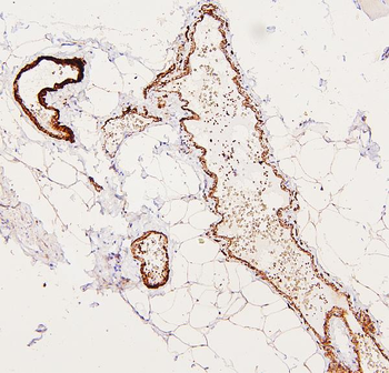 Filamin A/FLNA Antibody