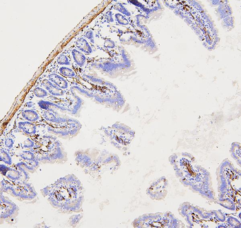 Filamin A/FLNA Antibody