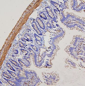 Filamin A/FLNA Antibody