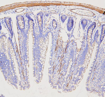 Filamin A/FLNA Antibody