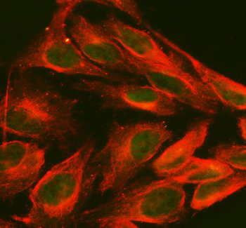 FOXC1 Rabbit Polyclonal Antibody