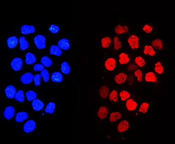 Histone H1.0/H1F0 Antibody