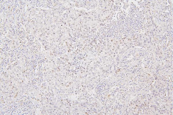 Histone H1.0/H1F0 Antibody
