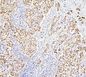 Histone H1.0/H1F0 Antibody