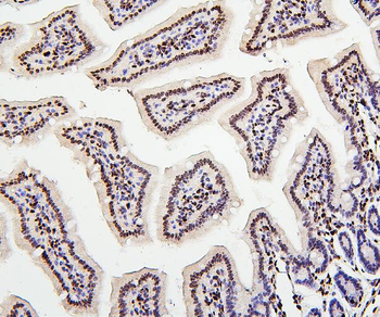 Histone H1.0/H1F0 Antibody