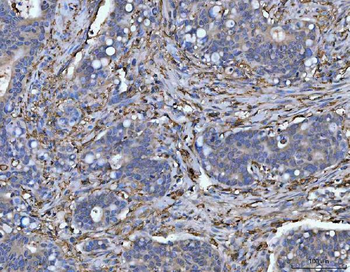 HLA-DR/HLA-DRA Antibody