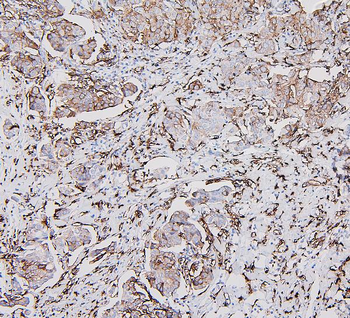 HLA-DR/HLA-DRA Antibody