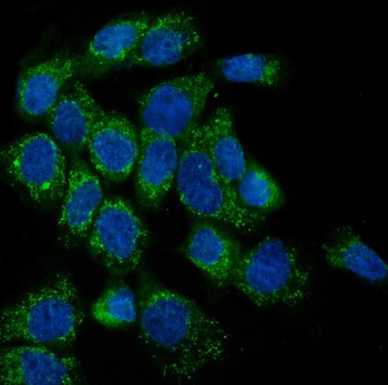Lipoma-preferred partner LPP Antibody