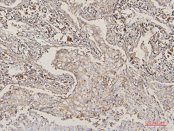 Lipoma-preferred partner LPP Antibody