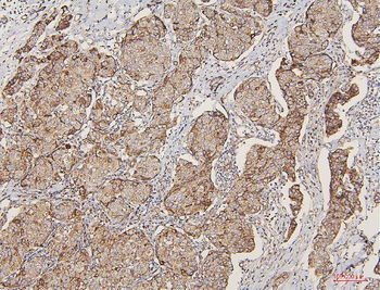 Lipoma-preferred partner LPP Antibody