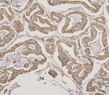 Lipoma-preferred partner LPP Antibody