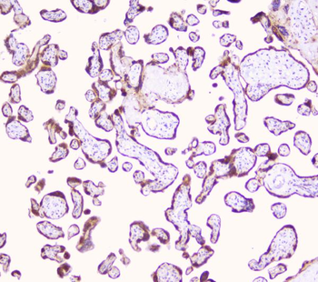 LRTOMT Rabbit Polyclonal Antibody