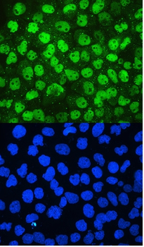 MCM2 Antibody