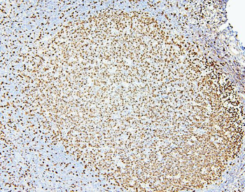 MCM2 Antibody
