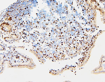MCM2 Antibody
