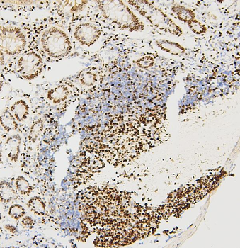 MCM2 Antibody